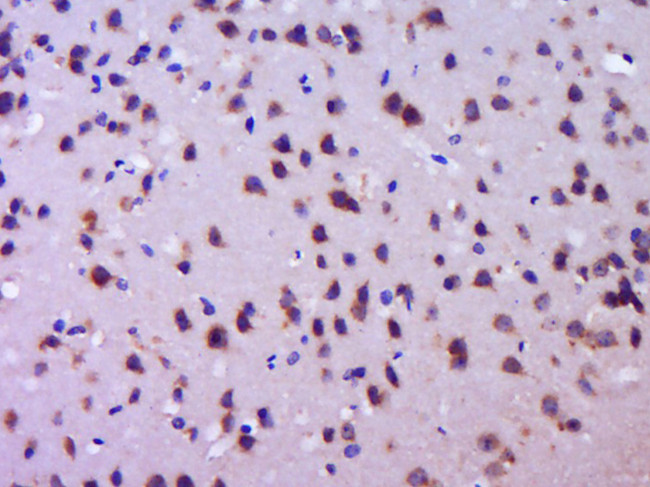 Tau Antibody in Immunohistochemistry (Paraffin) (IHC (P))