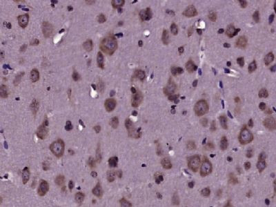 Tau Antibody in Immunohistochemistry (Paraffin) (IHC (P))