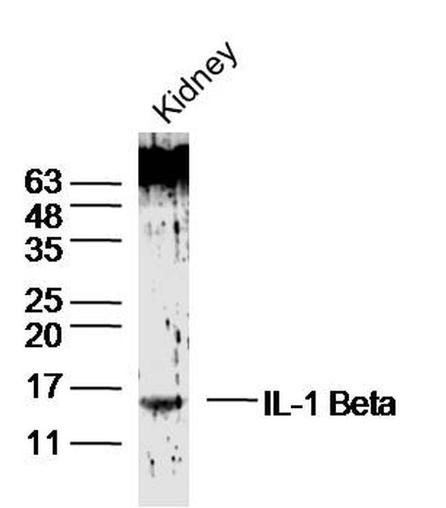 IL-1 Beta Antibody in Western Blot (WB)