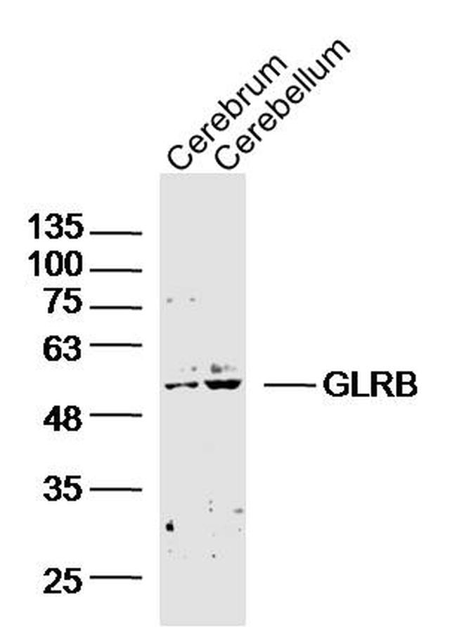 GLRB Antibody in Western Blot (WB)