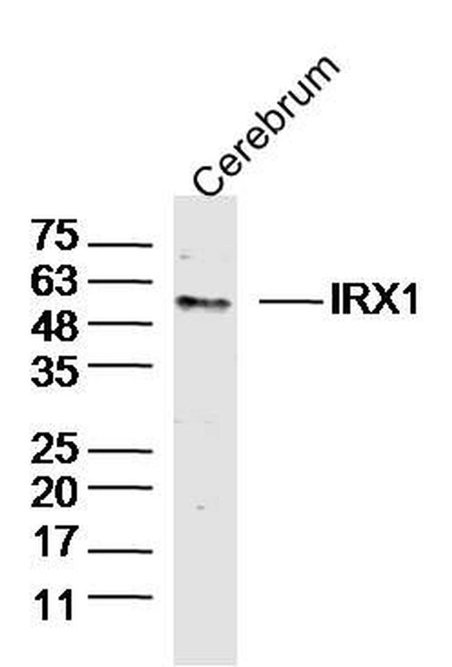 IRX1 Antibody in Western Blot (WB)