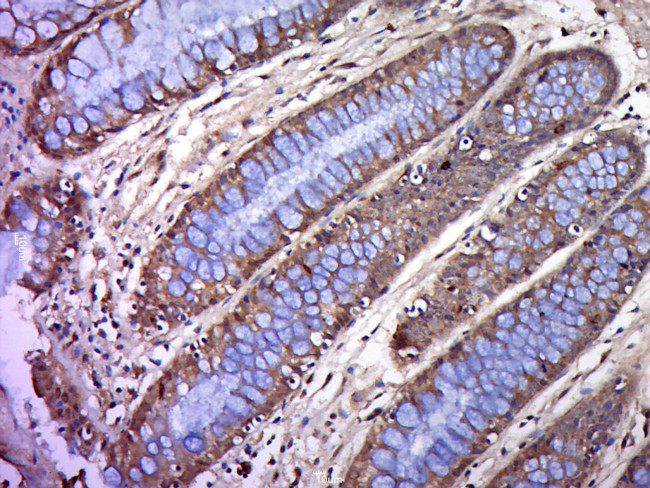 BTN2A1 Antibody in Immunohistochemistry (Paraffin) (IHC (P))