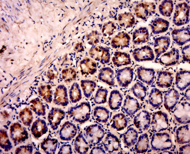SOX10 Antibody in Immunohistochemistry (Paraffin) (IHC (P))