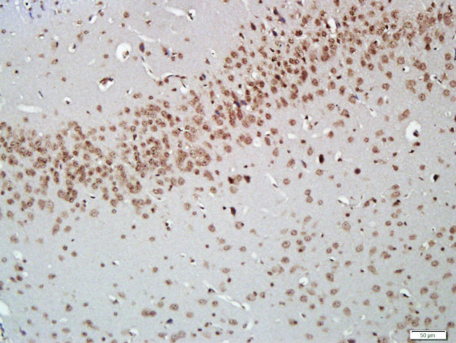 AKT2 Antibody in Immunohistochemistry (Paraffin) (IHC (P))