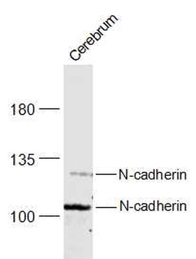 N-cadherin Antibody in Western Blot (WB)