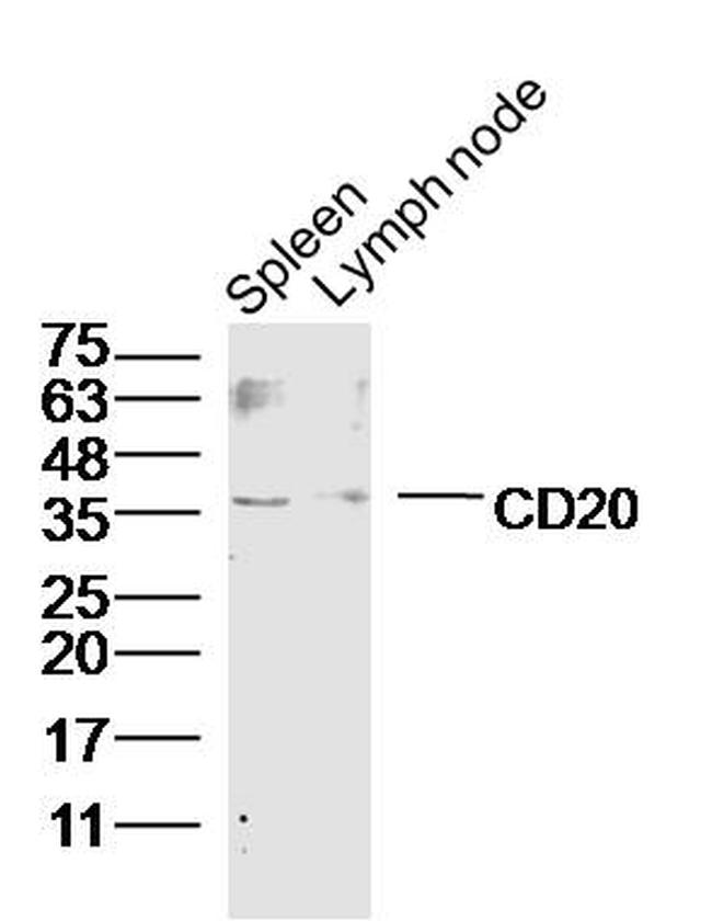 CD20 Antibody in Western Blot (WB)