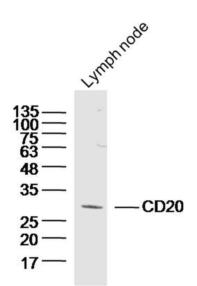 CD20 Antibody in Western Blot (WB)