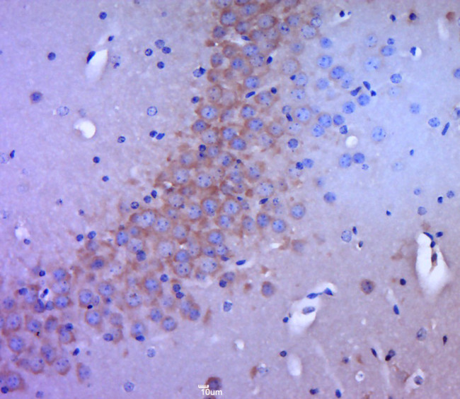 DLG4 Antibody in Immunohistochemistry (Paraffin) (IHC (P))