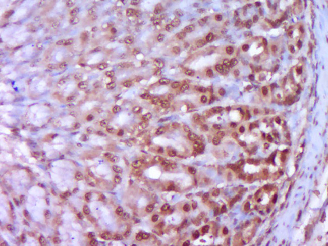 HSP27 Antibody in Immunohistochemistry (Paraffin) (IHC (P))