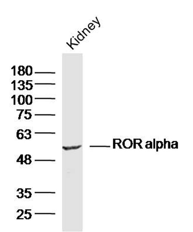 ROR alpha Antibody in Western Blot (WB)