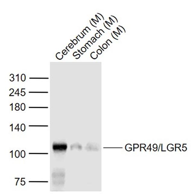 GPR49/LGR5 Antibody in Western Blot (WB)