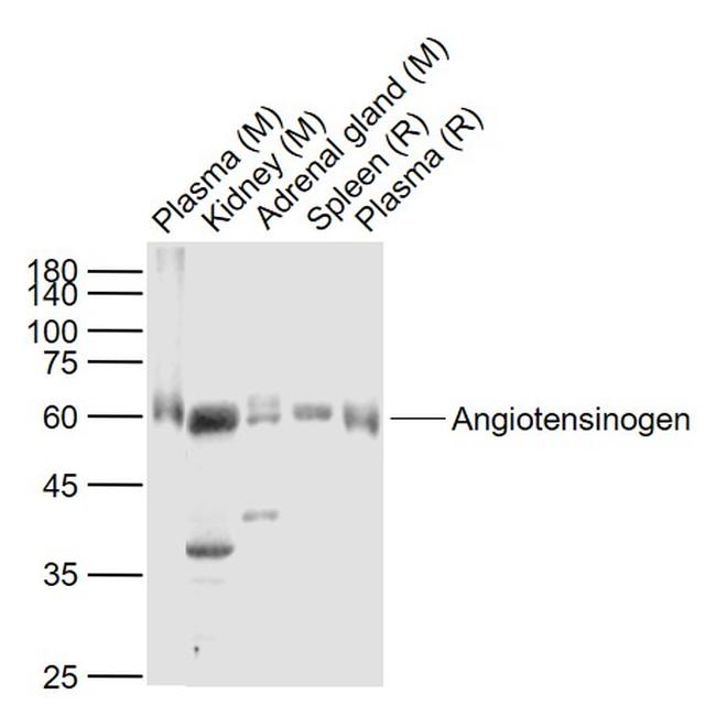 Angiotensinogen Antibody in Western Blot (WB)
