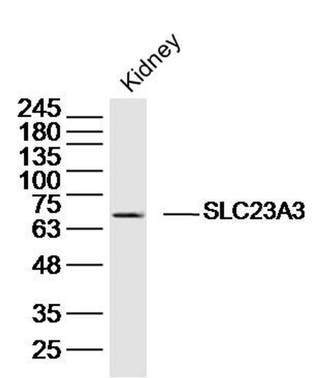 SLC23A3 Antibody in Western Blot (WB)