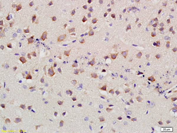 kNBC Antibody in Immunohistochemistry (Paraffin) (IHC (P))