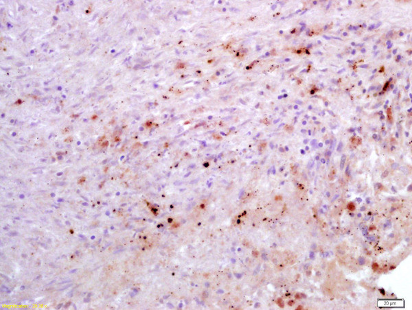 Estrogen Receptor alpha Antibody in Immunohistochemistry (Paraffin) (IHC (P))