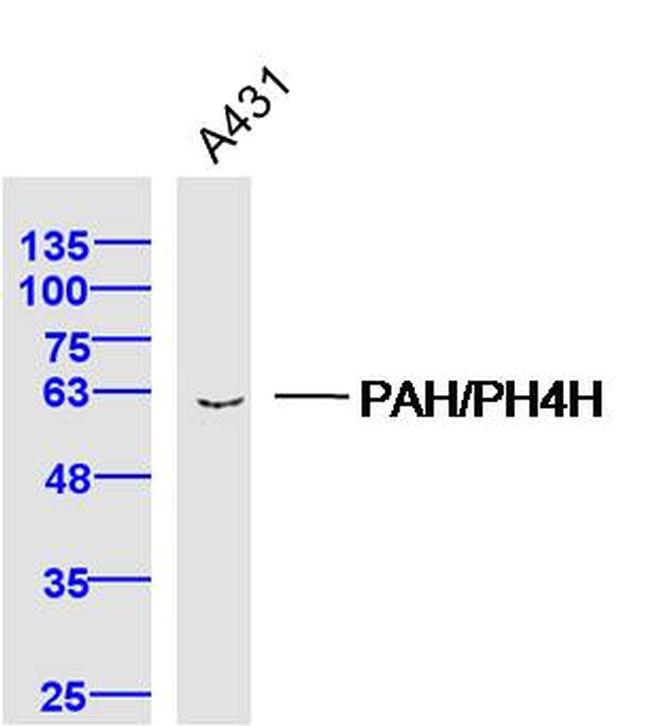 PAH/PH4H Antibody in Western Blot (WB)