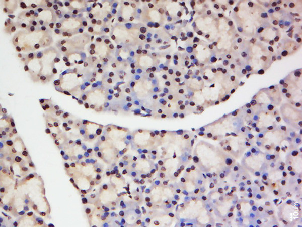 TNFAIP1 Antibody in Immunohistochemistry (Paraffin) (IHC (P))