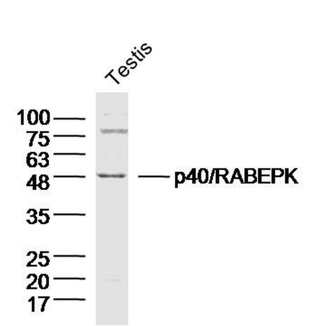 p40/RABEPK Antibody in Western Blot (WB)