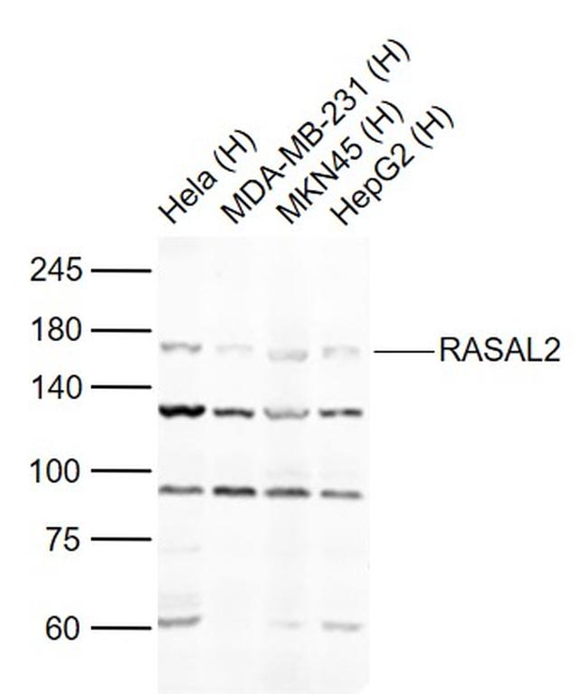 RASAL2 Antibody in Western Blot (WB)