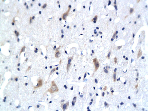 5-HTR3/HTR3A Antibody in Immunohistochemistry (Paraffin) (IHC (P))