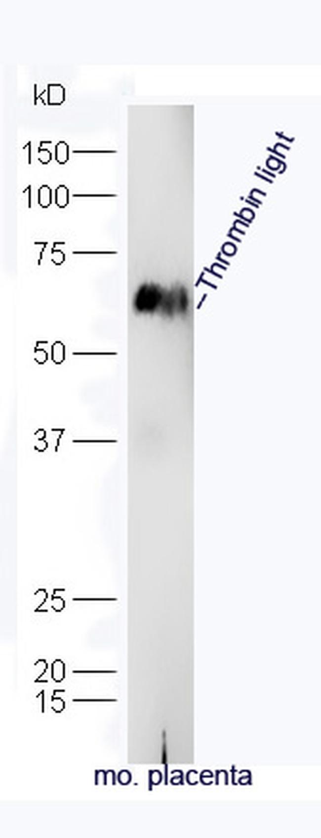 Thrombin light chain Antibody in Western Blot (WB)