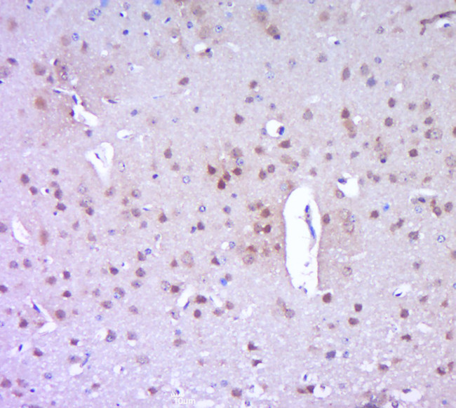 PARP1 Antibody in Immunohistochemistry (Paraffin) (IHC (P))