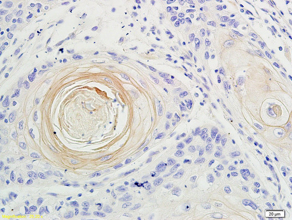 IL-17 Antibody in Immunohistochemistry (Paraffin) (IHC (P))
