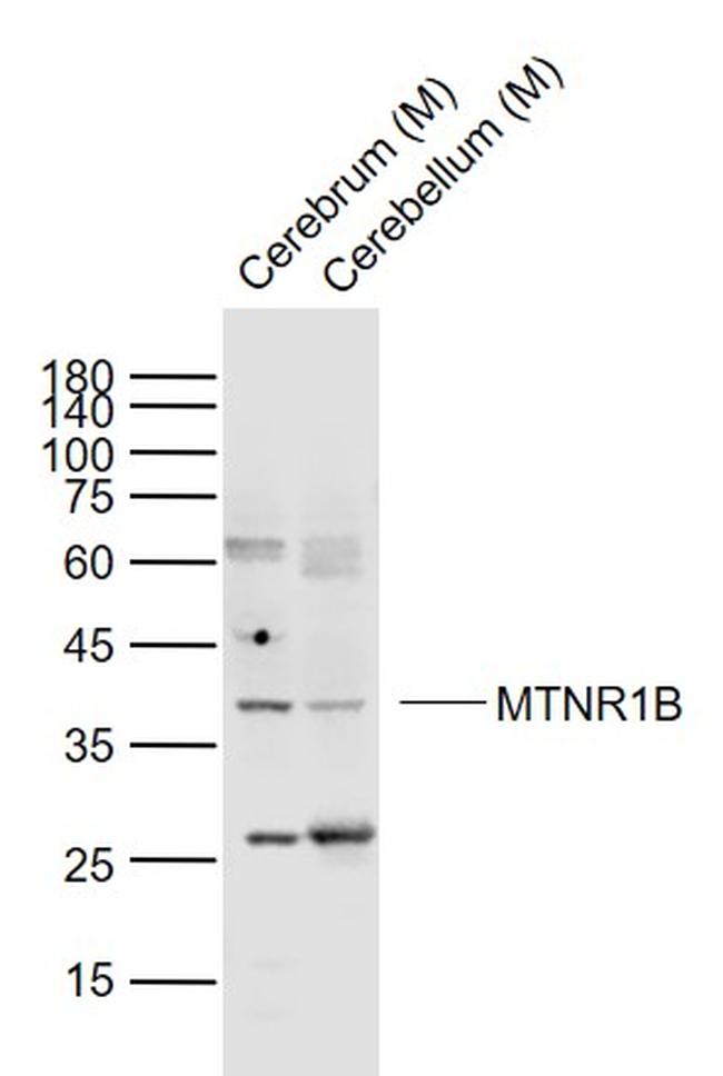 MTNR1B Antibody in Western Blot (WB)
