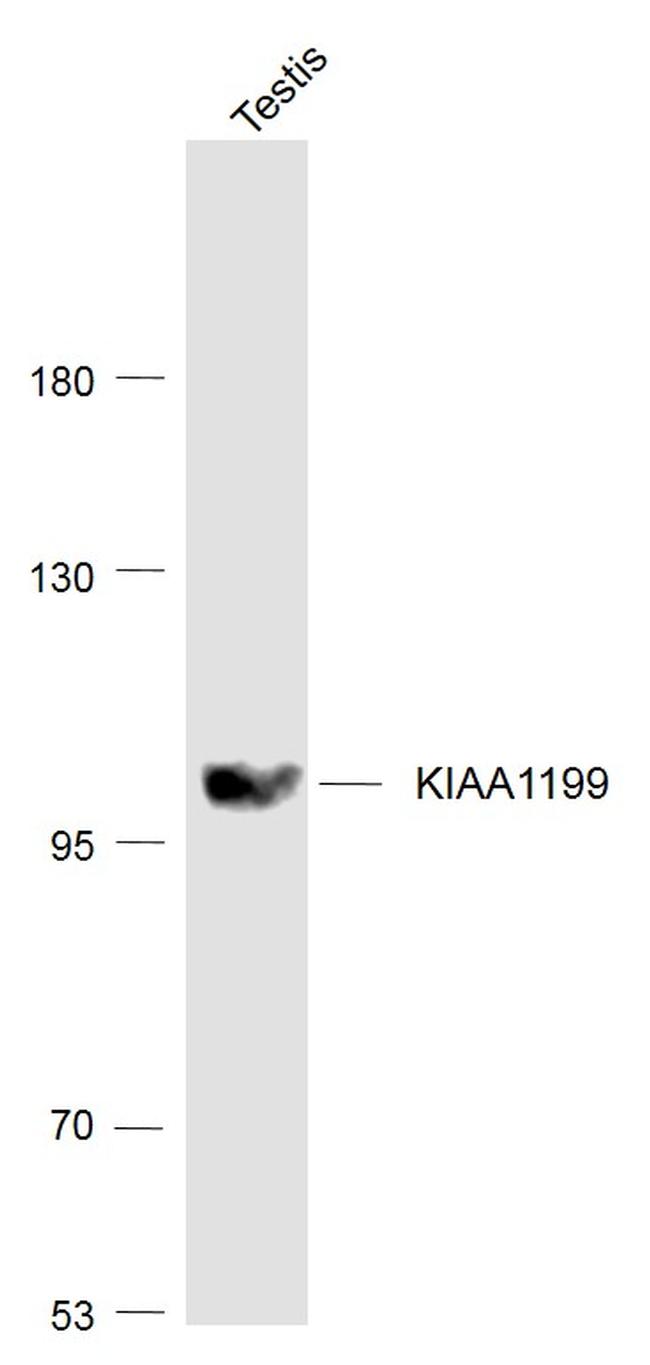 KIAA1199 Antibody in Western Blot (WB)