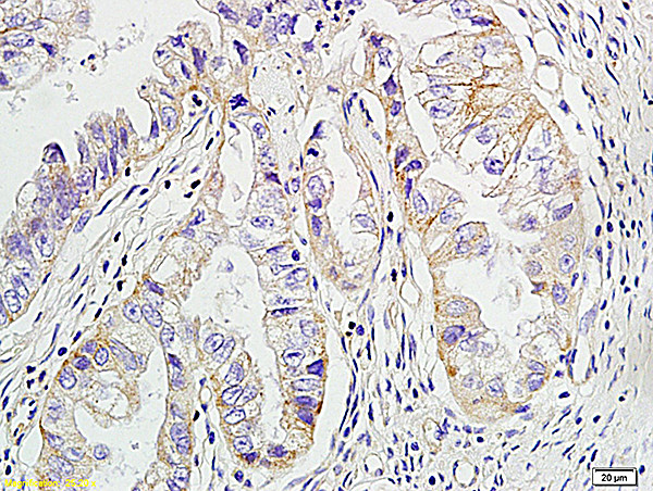 ErbB2 Antibody in Immunohistochemistry (Paraffin) (IHC (P))