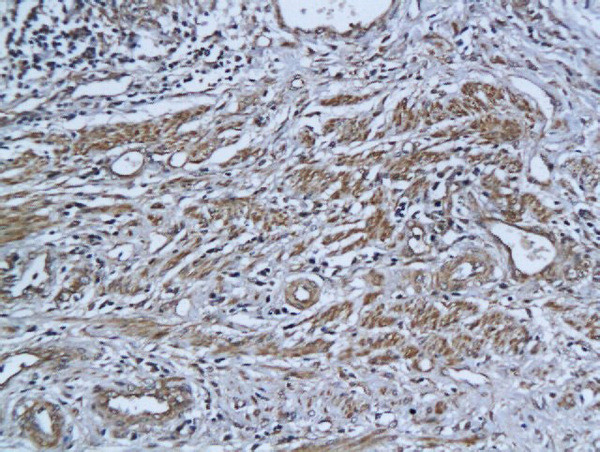 ADAR1 Antibody in Immunohistochemistry (Paraffin) (IHC (P))