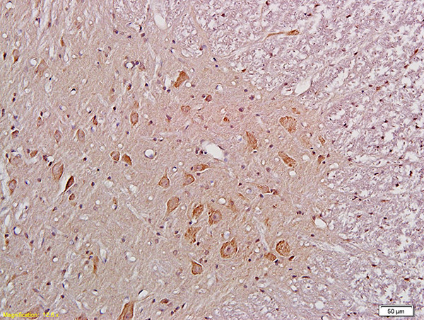 NMDAR1 Antibody in Immunohistochemistry (Paraffin) (IHC (P))