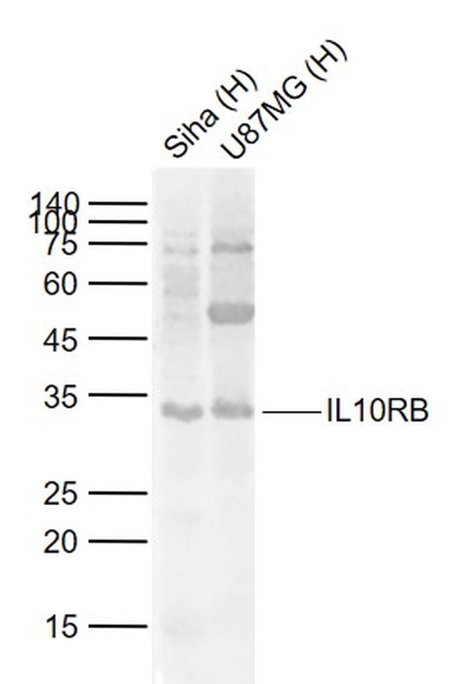 IL10RB Antibody in Western Blot (WB)