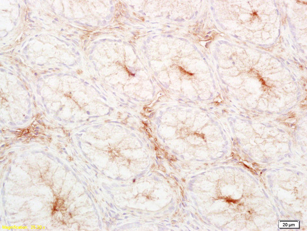 LDL Antibody in Immunohistochemistry (Paraffin) (IHC (P))
