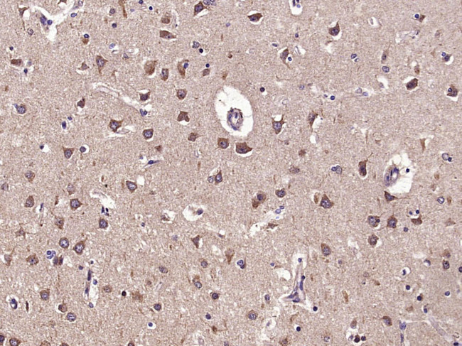 Phospho-GEF H1 (Ser886) Antibody in Immunohistochemistry (Paraffin) (IHC (P))
