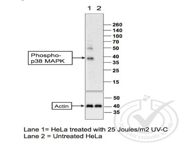 Phospho-p38 MAPK (Thr180, Tyr182) Antibody in Western Blot (WB)