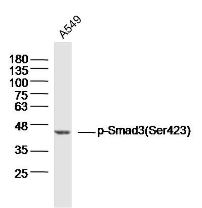 Phospho-Smad3 (Ser423) Antibody in Western Blot (WB)