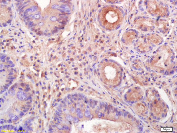 LYRIC Antibody in Immunohistochemistry (Paraffin) (IHC (P))