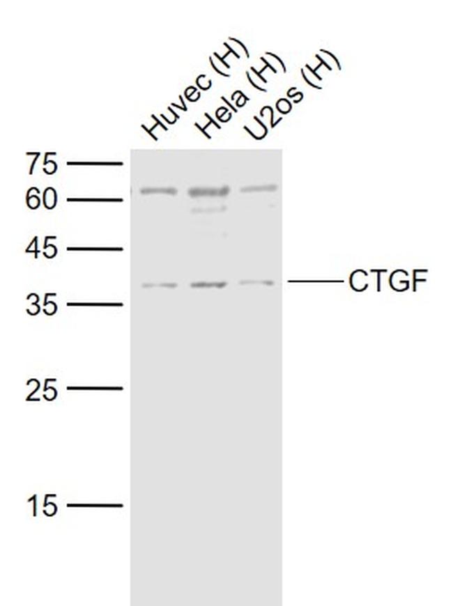CTGF Antibody in Western Blot (WB)