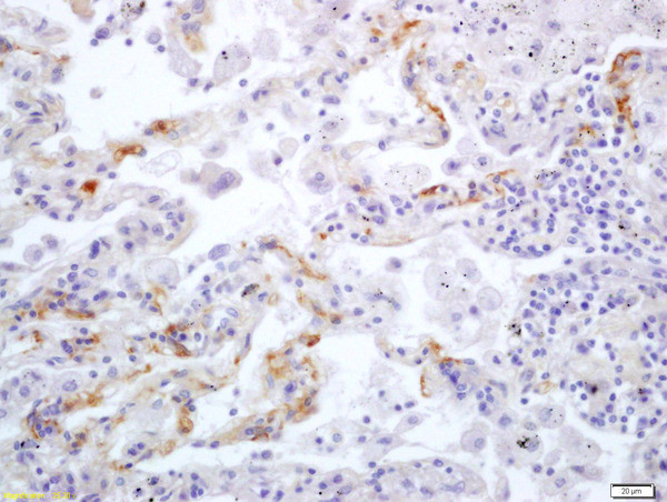 Integrin alpha V/CD51 Antibody in Immunohistochemistry (Paraffin) (IHC (P))