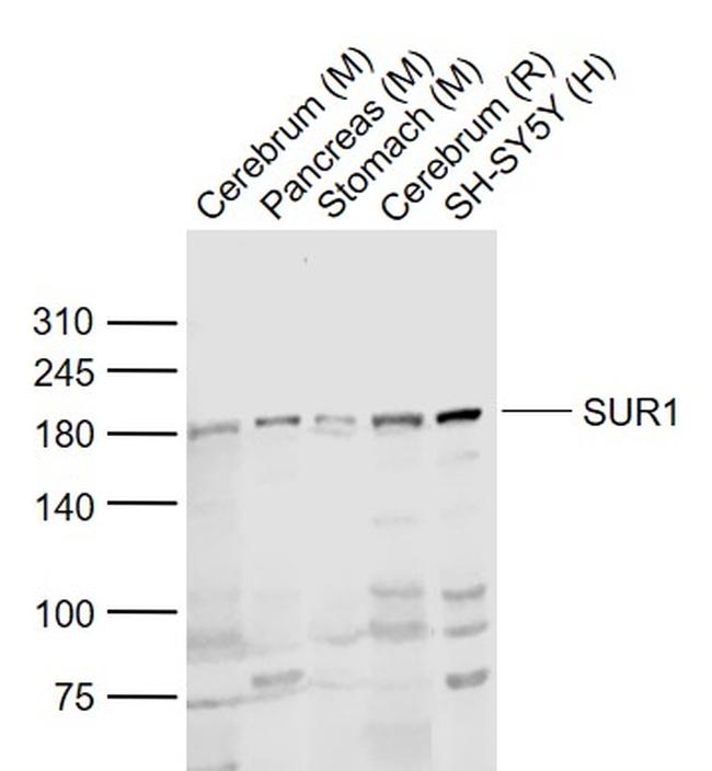 SUR1 Antibody in Western Blot (WB)