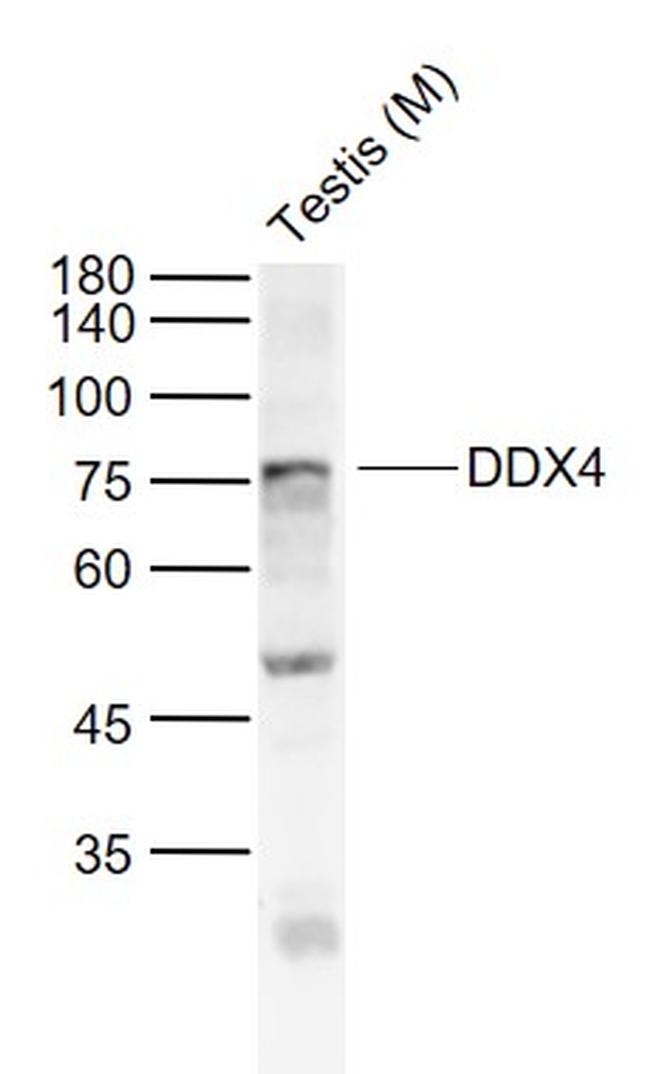 DDX4 Antibody in Western Blot (WB)