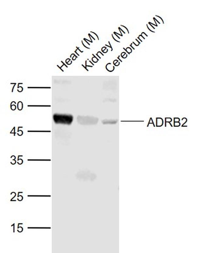 ADRB2 Antibody in Western Blot (WB)
