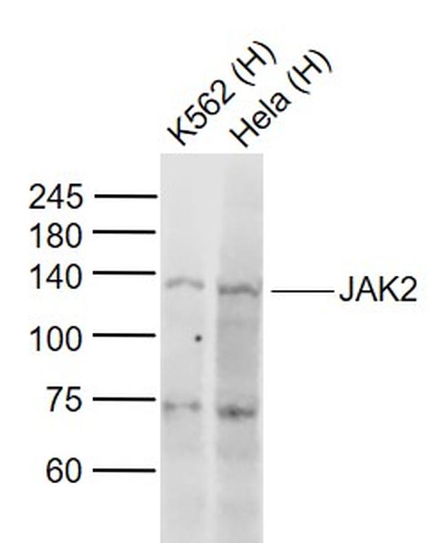JAK2 Antibody in Western Blot (WB)