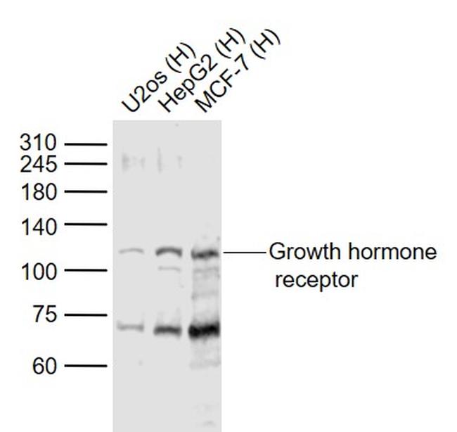 Growth hormone receptor Antibody in Western Blot (WB)