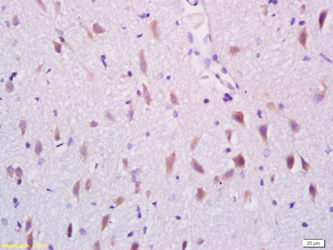 ARHGAP17 Antibody in Immunohistochemistry (Paraffin) (IHC (P))