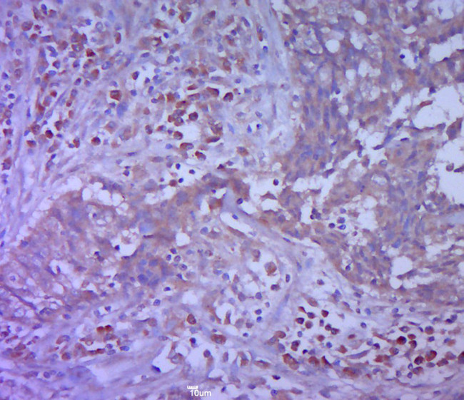 Vimentin Antibody in Immunohistochemistry (Paraffin) (IHC (P))
