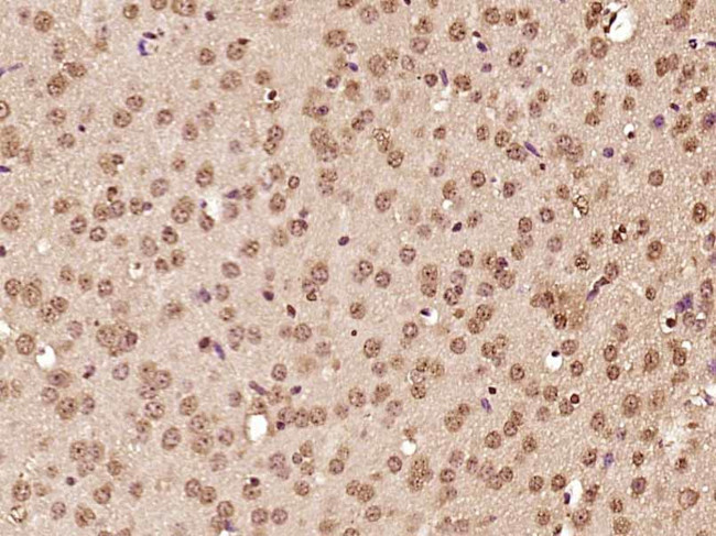ATF6 Antibody in Immunohistochemistry (Paraffin) (IHC (P))