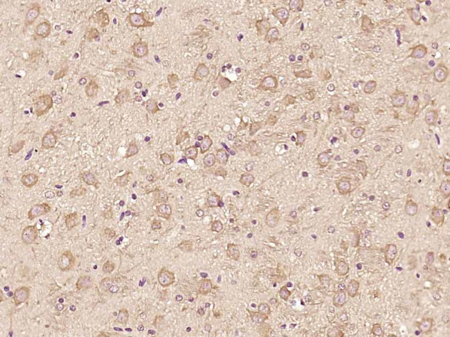 ATF6 Antibody in Immunohistochemistry (Paraffin) (IHC (P))