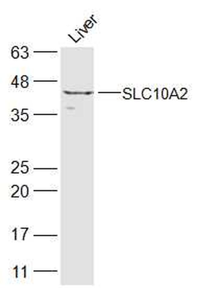 SLC10A2 Antibody in Western Blot (WB)